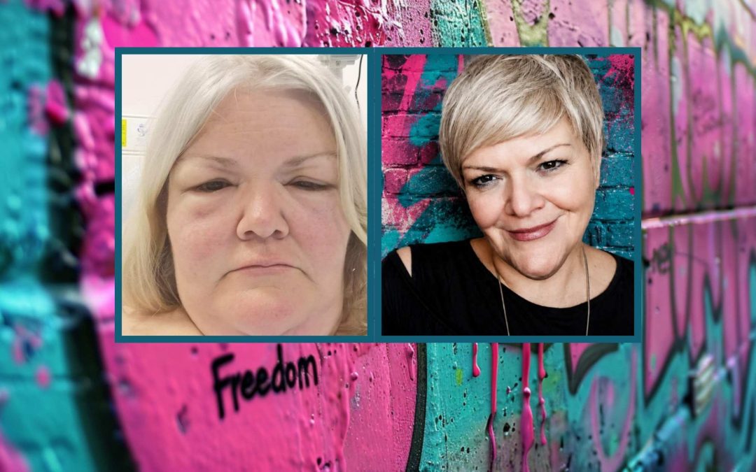 How I Healed My Autoimmune Conditions With Therapeutic Nutrition