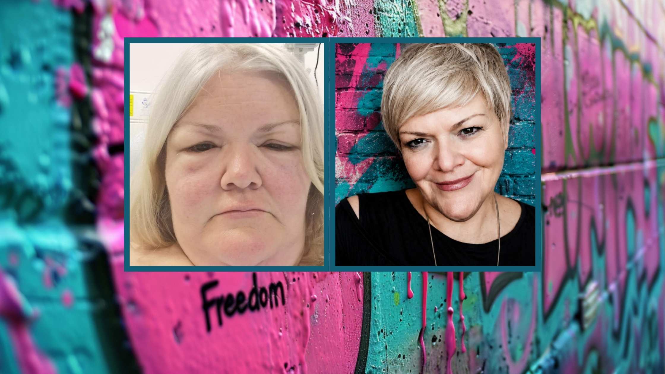 Linda McClure before and after autoimmune healing using therapeutic carbohydrate restriction and carnivore nutrition